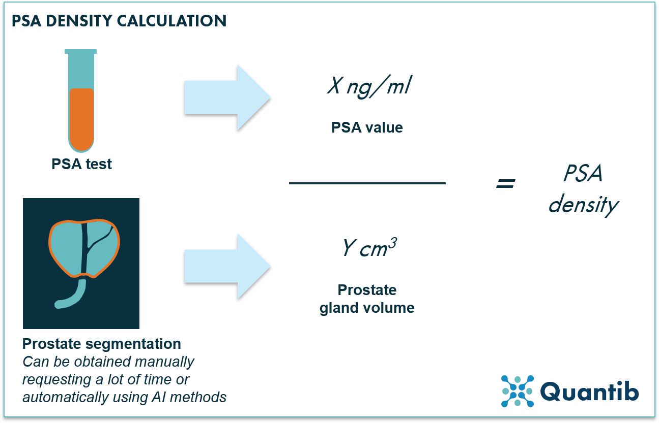 6 ways AI can support prostate MRI reporting